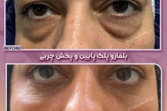 Surgical-Case-5