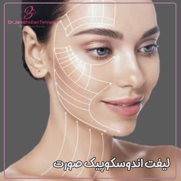لیفت اندوسکوپیک صورت - دکتر منصوره جمشیدیان طهرانی