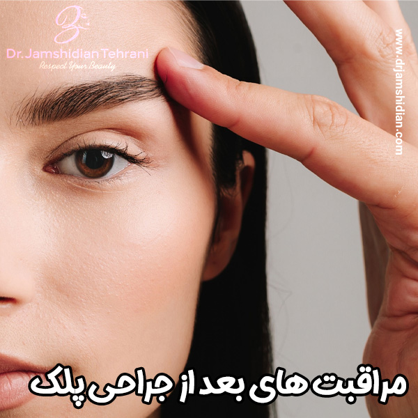 مراقبت های بعد از جراحی بلفاروپلاستی - دکتر منصوره جمشیدیان طهرانی