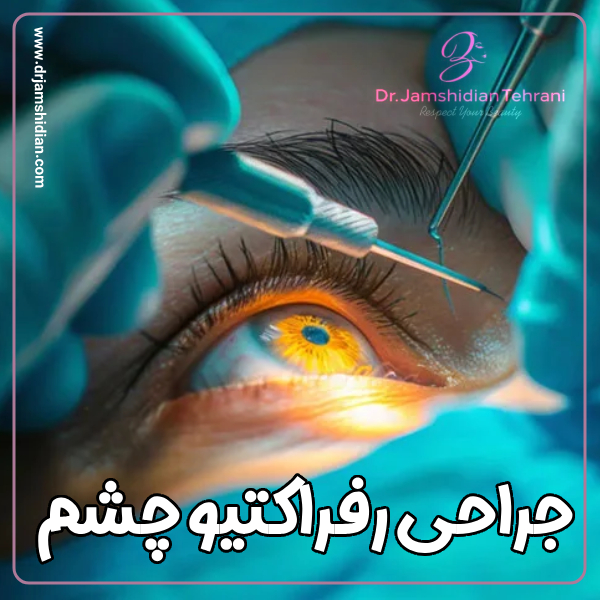 جراحی رفراکتیو چشم با دکتر جمشیدیان در تهران