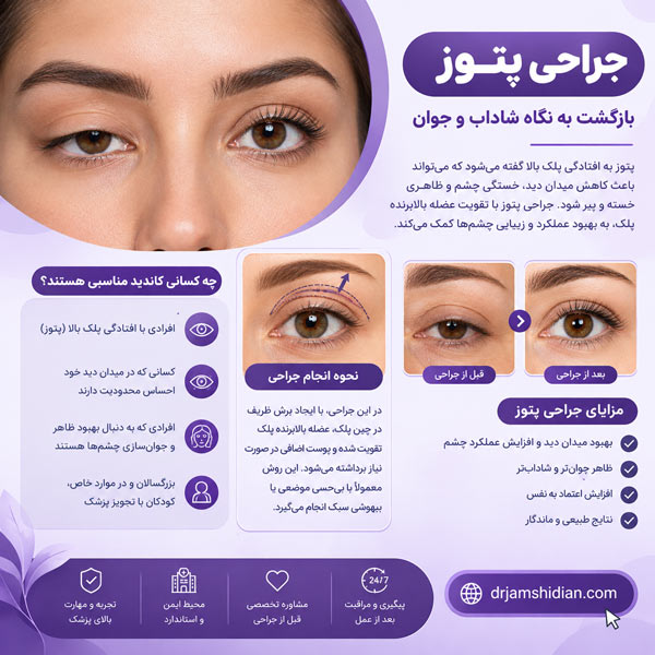 جراحی پتوز  - دکتر جمشیدیان