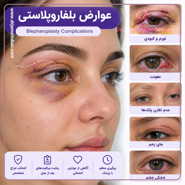 عوارض بلفاروپلاستی - دکتر جمشیدیان