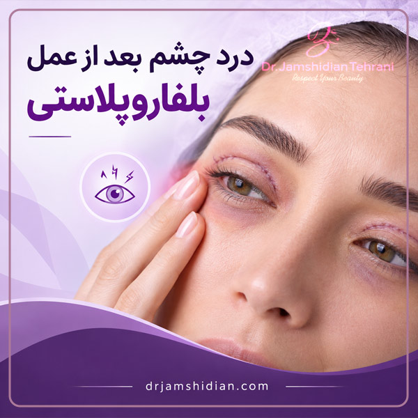 درد چشم بعد از بلفاروپلاستی - دکتر جمشیدیان