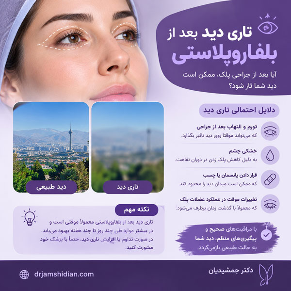 تاری دید بعد از بلفاروپلاستی - دکتر جمشیدیان