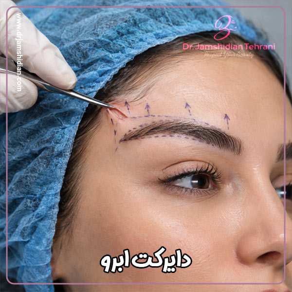 دایرکت ابرو - دکتر منصوره جمشیدیان