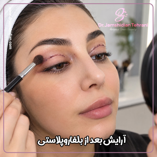 آرایش بعد از بلفاروپلاستی - دکتر جمشیدیان